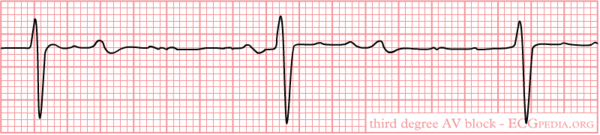 Episode 10 The Pharmacist And The Ecg Should Be Friends